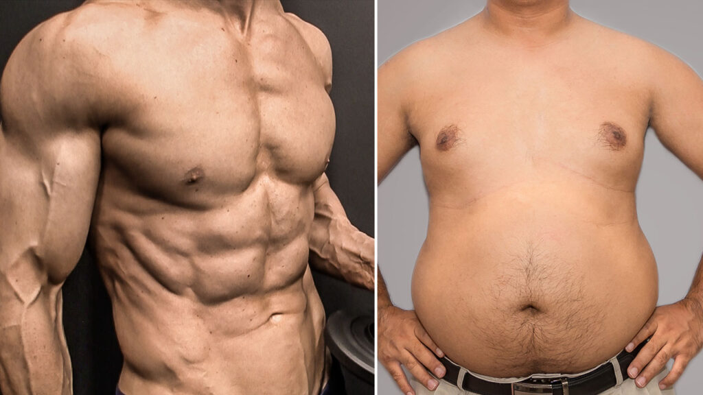 How Long Does It Take to Get Rid of Man Boobs
