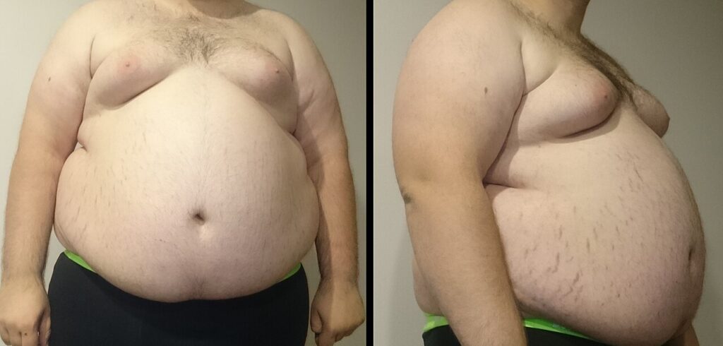 Why Men Store Fat in the Midsection